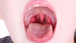 Home Remedy for Tonsils  Health Tips [upl. by Dowski]