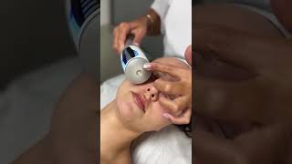 Endosphere Facial Therapy buckinghampalace london [upl. by Giule]