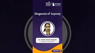 Diagnosis of Leprosy  Explained by Our Expert Dr Syeda Nikhat Baquer Consultant  Dermatologist [upl. by Hcnarb]