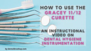 How to use the Gracey 1112 Curette [upl. by Satsoc]