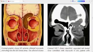 RADIOLOGY EXAM CASES [upl. by Endres]