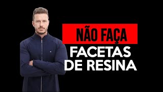 NÃO FAÇA FACETAS DE RESINA [upl. by Lebasiairam]