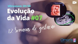 Gravidez 12 semanas Ultrassom morfológico translucência nucal Evolução da Vida 07 [upl. by Kursh]