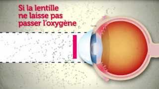 Lentilles de contact  attention les yeux [upl. by Elsbeth]