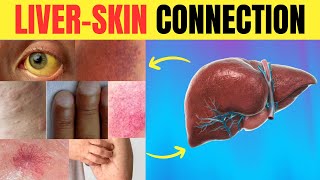 😱 Is Your Skin SCREAMING for Help 🆘 11 LIVER WARNING Signs You Might Miss  Longevity Deprocessed [upl. by Swiercz]