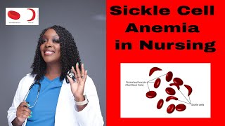 Sickle Cell Anemia in Nursing [upl. by Singhal]