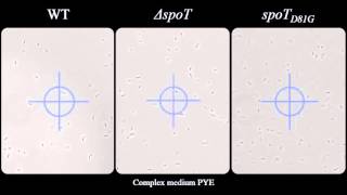 Phosphotransferasedependent accumulation of pppGpp in response to glutamine deprivation [upl. by Aelgna451]