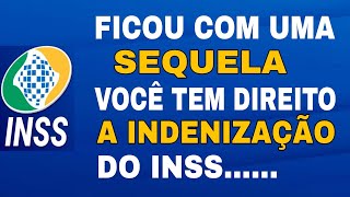 MUITOS SEGURADOS TEM DIREITO É NÃO SABEM o que fazer pra conseguir [upl. by Adleme]