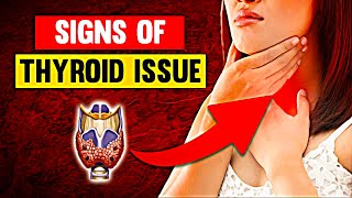 8 Surprising Signs You May Have a Thyroid Issue [upl. by Hillell313]