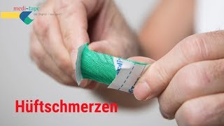 Eine Hüftarthrose Coxarthrose ist meistens kein Grund für eine Hüftoperation [upl. by Annig]