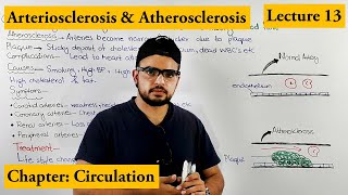 Arteriosclerosis amp Atherosclerosis CardioVascularDisorder  Chapter circulation Video  13 [upl. by Coltun]