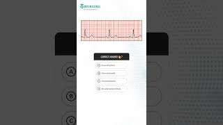 DHA Nurse Exam Question  Work in Dubai [upl. by Hendel]