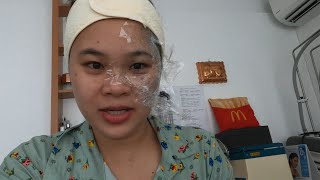 Birthmark Removal Laser Treatment in Dumaguete City Philippines [upl. by Lala]