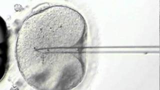 Intracytoplasmic sperm Injection ICSI [upl. by Ellemrac]