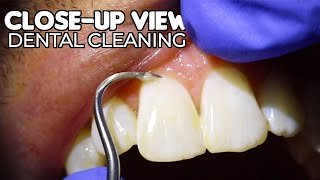 Dental Cleaning  CloseUp View ASMR [upl. by Janessa]