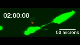 Example of intercellular transfer of proteins GFP via tunneling nanotubes connnecting cancer cells [upl. by Lennor]