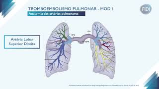 Tromboembolismo pulmonar  Parte 1 [upl. by Jessalyn]