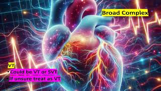 BROAD COMPLEX TACHYCARDIA IN PEDIATRICS [upl. by Imaon]