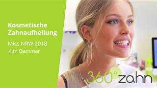 Kosmetische Zahnaufhellung  Miss NRW 2018  Kim Dammer bei 360°zahn [upl. by Leynad919]