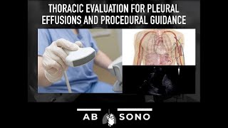 Thoracic evaluation for pleural effusions and procedural guidance [upl. by Nyleimaj]