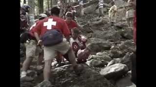 Mountain bike Crashes and broken bones better quality [upl. by Cousins]