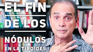 Episodio 1100 El fin de los nódulos en la tiroides [upl. by Akinot]