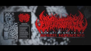 ABATED MASS OF FLESH  MORTAL INFRACTION SINGLE 2024 SW EXCLUSIVE [upl. by Tsui]