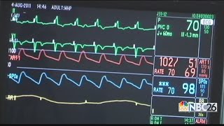 Medical Monday Stroke Month All you need to know about stroke [upl. by Dnalyar264]