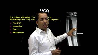 eQ Recent Exam Question Radiology  Sequestrum [upl. by Revorg]