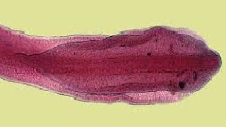 Para GIT  General Characters of Cestoda  Diphyllobothrium latum Fish tape worm  broad tape worm [upl. by Esahc]