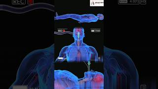 Liquid Ventilation Medical 3D Animation short [upl. by Burg]