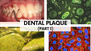 DENTAL PLAQUE  Part 1 II Plaque as a Biofilm Composition amp Classification [upl. by Follmer401]