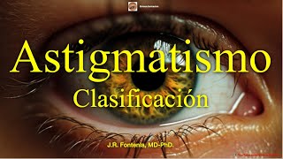 Clasificación del Astigmatismo [upl. by Amuwkuhc]