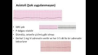 İLERİ YAŞAM DESTEĞİ 2024 [upl. by Leak]