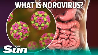 What is norovirus and how long does sickness bug last [upl. by Tolley668]