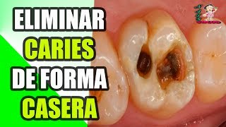 Cómo Eliminar Las Caries De Forma Casera Sin Ir Al Dentista 3 SIMPLES TRUCOS [upl. by Kcira]