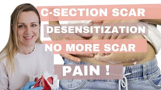 Csection scar desensitization no more scar pain Tips for better Csection recovery [upl. by Nalek]