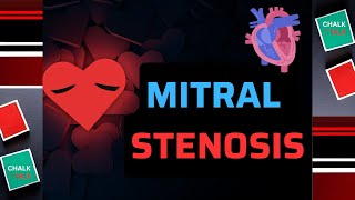 Mitral Valve Stenosis [upl. by Surtemed]