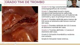 5 Nomenclatura utilizada en hemodinamia [upl. by Eelaras]