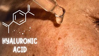 Does Hyaluronic Acid Really Works [upl. by Arron516]