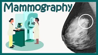 Mammography Test  Mammogram for breast cancer  What to expect  How to identify breast cancer [upl. by Synned]