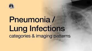 Pneumonia  Lung Infections [upl. by Johst]