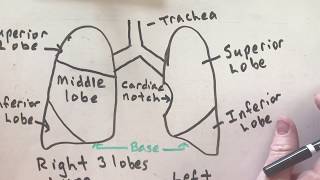 Clinical Case  Cavitating pneumonia  Chest Xray and CT Scan  Radiology tutorial [upl. by Faubion]