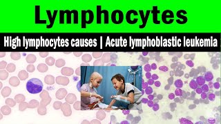 Lymphocytes  High lymphocytes causes  Acute lymphoblastic leukemia [upl. by Armmat]