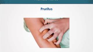 Pruritus  Dermatology  EduRx [upl. by Ennaimaj]