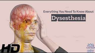 Dysesthesia 101 A Comprehensive Guide to this Mysterious Condition [upl. by Ssitruc]