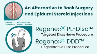 Regenexx PLDisc Avoid the Harmful Side Effects of Epidural Steroids and Back Surgery [upl. by Noswal900]