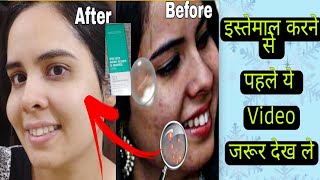 How To Reduce Dark Spots Dermatouch Bye Bye acne scarsBye Bye Pigmentation Review dermatouch [upl. by Thormora]