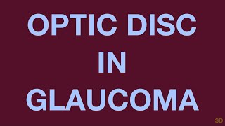 Glaucoma Session 06 Clinical Evaluation of a Glaucoma Patient Part 3 Fundus Examination [upl. by Weiman560]