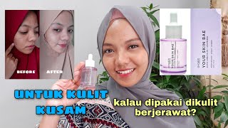 REVIEW AVOSKIN YOUR SKIN BAE alpha arbutin 3  grapeseed  setelah pemakain 2 minggu [upl. by Ttirb]